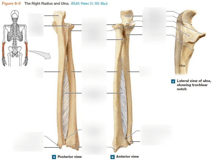 Labeled ulna and radius quiz