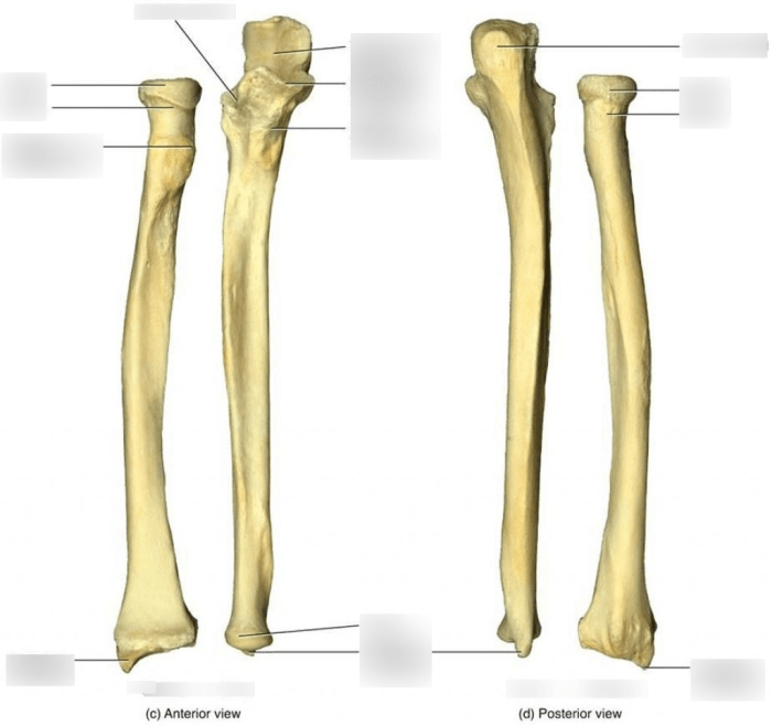 Labeled ulna and radius quiz