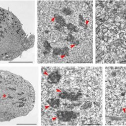 Complex anaphase apc promoting visualizing mechanisms functions panel diagram shows events which figure occurring during